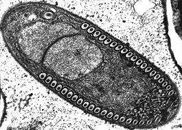 Мікроспоридія  Fibrillanosema crangonycis
