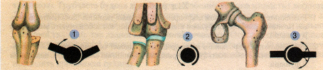 Види суглобів: 1 - одноосьовий; 2 - двохосьовий; 3 - трьохосьовий