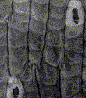 Клітини сфагніт під електронним мікроскопом