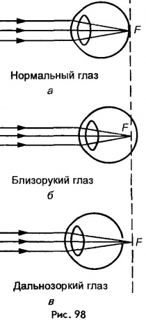 Дальнозоркость начинается с