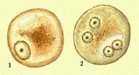 Дизентирійна амеба (Entamoeba histolycia)